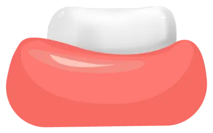 Muela